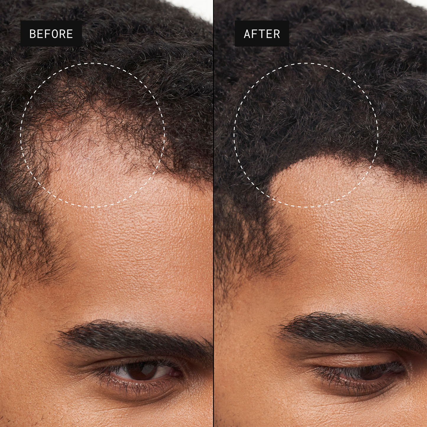 Toppik Pro Hair Fibers